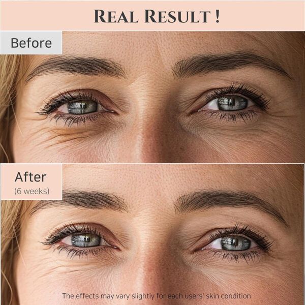 Revive Eye Serum: Ginseng + Retinal 30ml. - Imagen 3